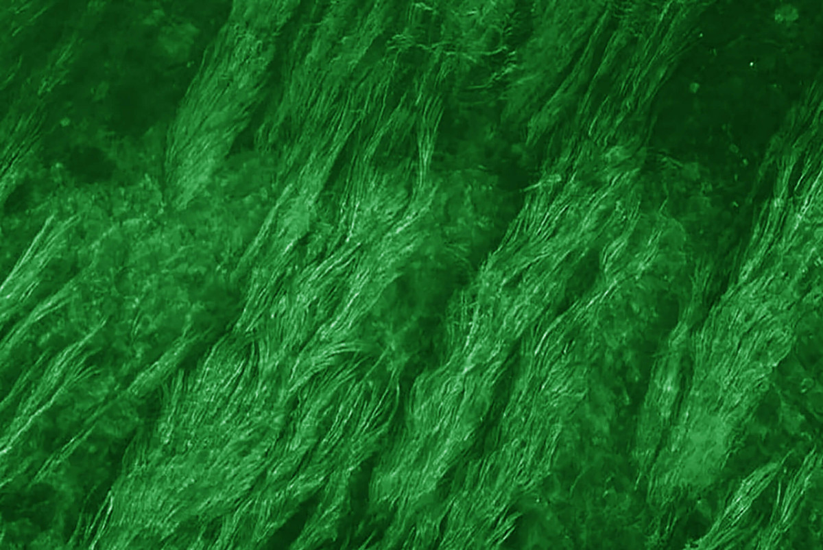 algea